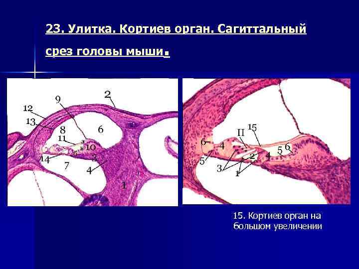 Аксиальный срез улитки схема строения спирального органа кортиев орган