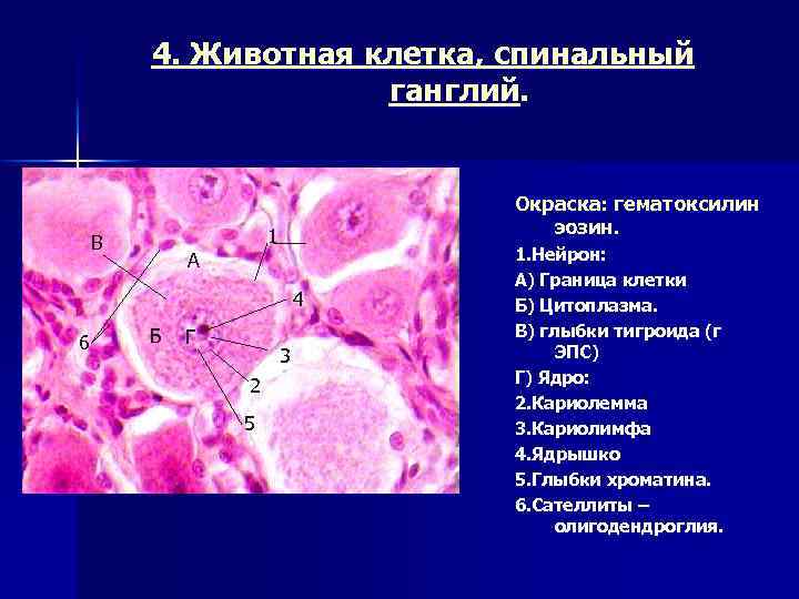 4. Животная клетка, спинальный ганглий. В Окраска: гематоксилин эозин. 1 А 4 6 Б