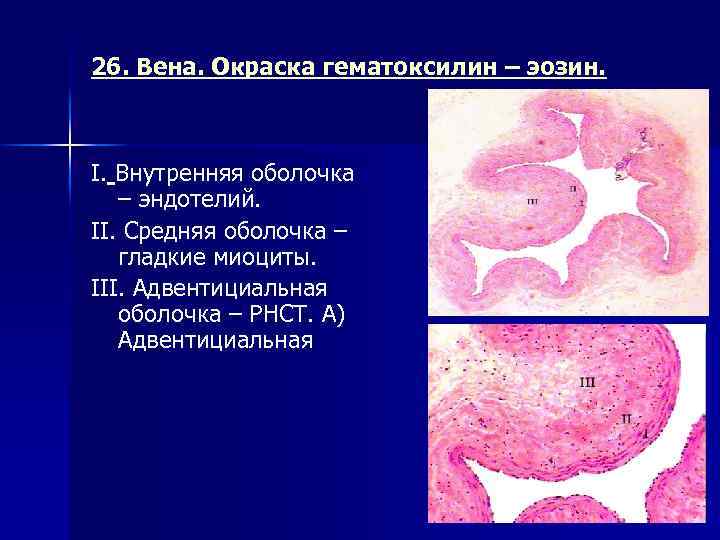 26. Вена. Окраска гематоксилин – эозин. I. Внутренняя оболочка – эндотелий. II. Средняя оболочка