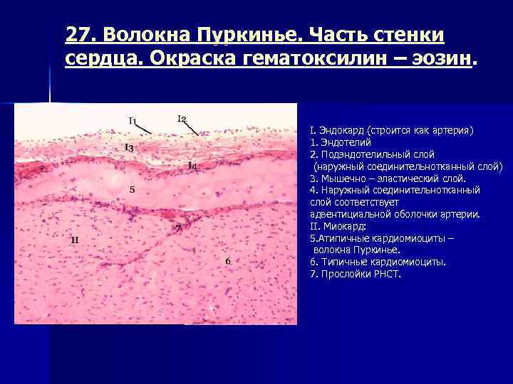 Срез стенки сердца рисунок