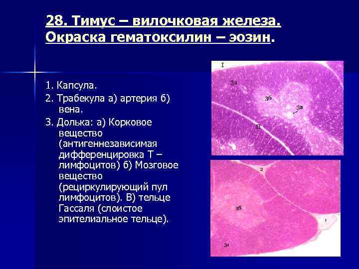 28. Тимус – вилочковая железа. Окраска гематоксилин – эозин. 1. Капсула. 2. Трабекула а)