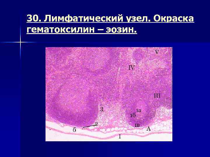 30. Лимфатический узел. Окраска гематоксилин – эозин. 
