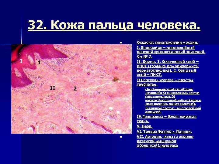 32. Кожа пальца человека. Окраска: гематоксилин – эозин. I. Эпидермис – многослойный плоский ороговевающий
