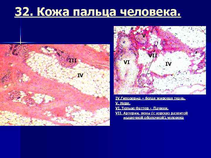32. Кожа пальца человека. V VII III VI IV IV IV. Гиподерма – белая