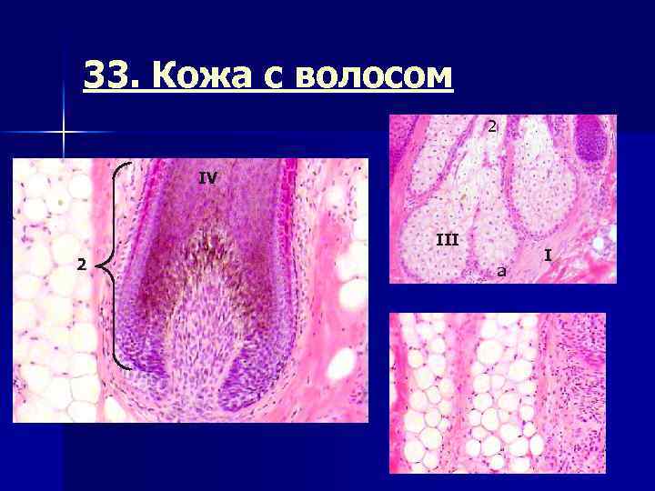 33. Кожа с волосом 2 IV III 2 а I 