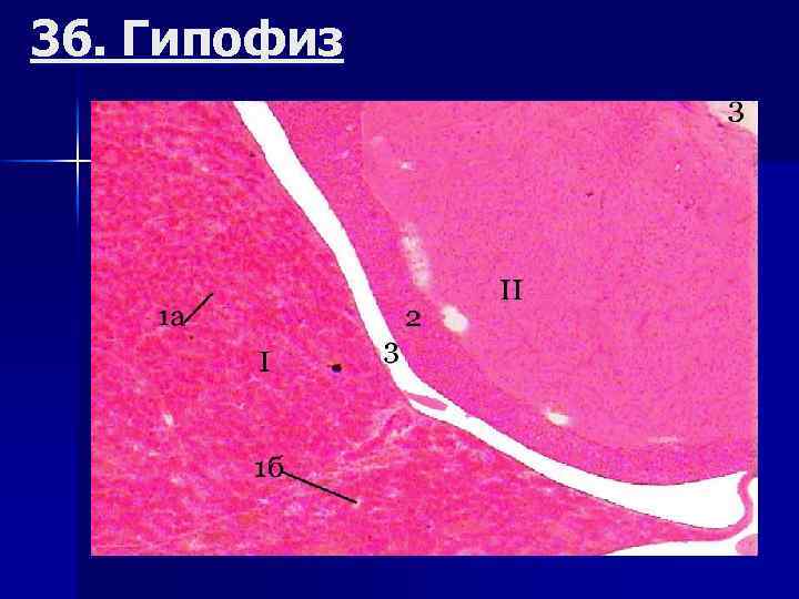 36. Гипофиз 