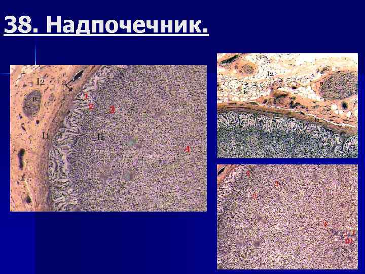 38. Надпочечник. 