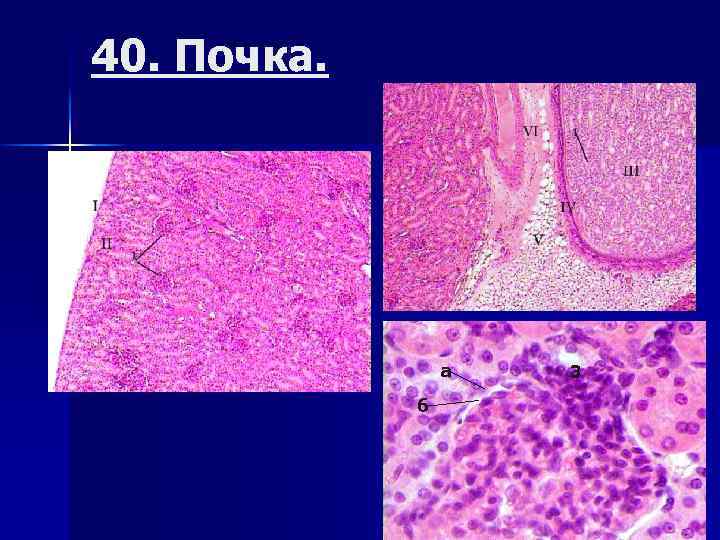40. Почка. а б 3 