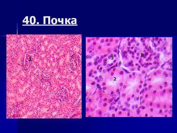 40. Почка 1 3 2 1 