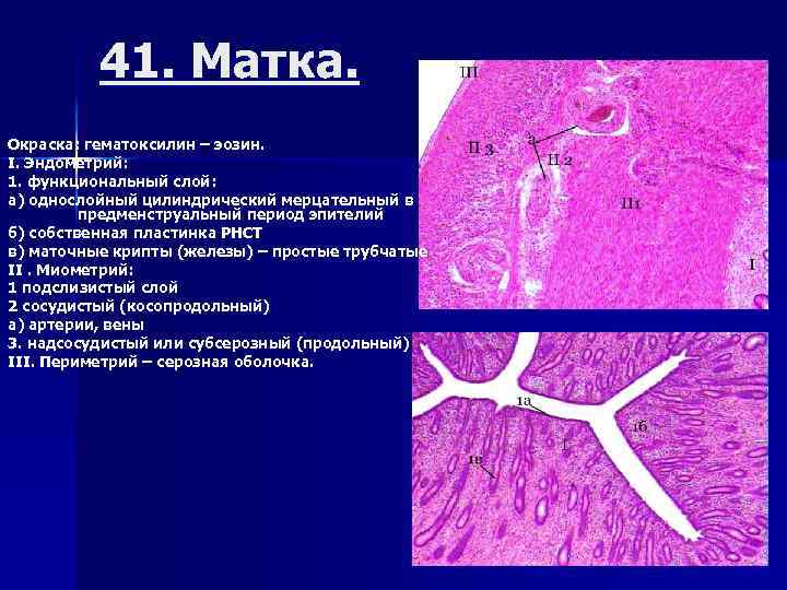 Железы матки. Простая неразветвленная трубчатая железа эндометрия матки. Простые трубчатые железы матки гистология. Простая неразветвленная трубчатая железа гистология. Маточные железы гистология препарат.