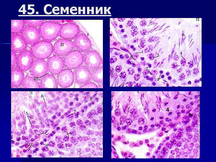 45. Семенник 4 