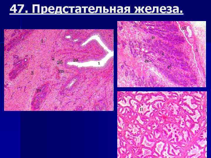 47. Предстательная железа. 