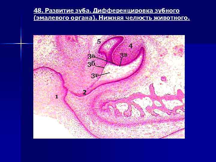 48. Развитие зуба. Дифференцировка зубного (эмалевого органа). Нижняя челюсть животного. 2 