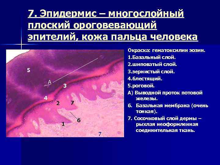 Многослойный плоский ороговевающий эпителий кожи пальца рисунок