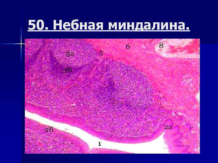 50. Небная миндалина. 