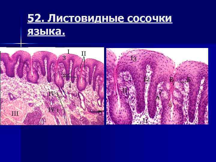 52. Листовидные сосочки языка. 