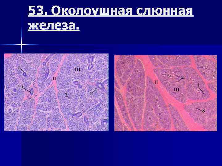 Околоушная слюнная железа гистология рисунок