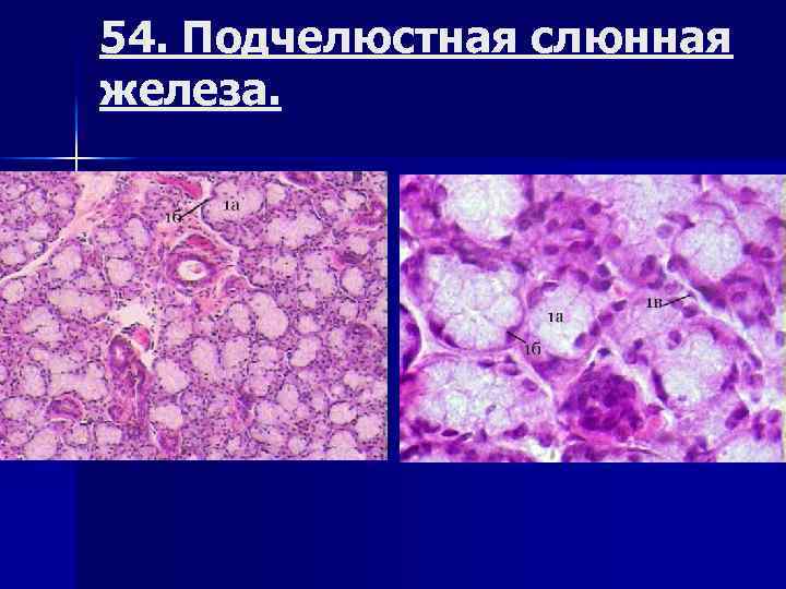 Подчелюстная железа