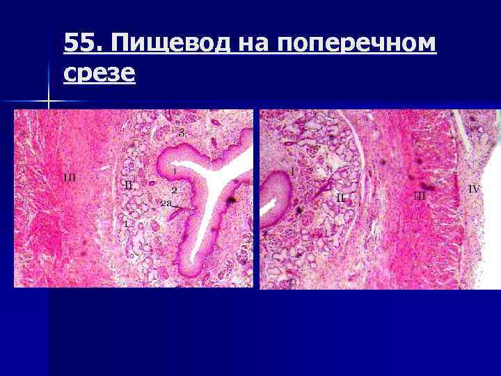 55. Пищевод на поперечном срезе 