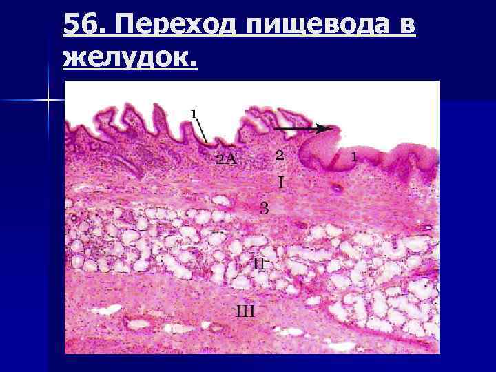 56. Переход пищевода в желудок. 