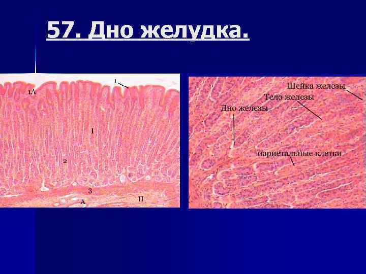 57. Дно желудка. 