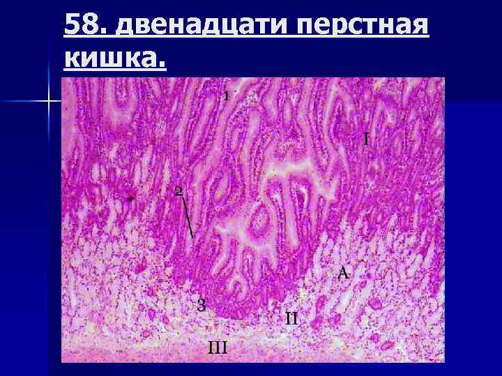 58. двенадцати перстная кишка. 