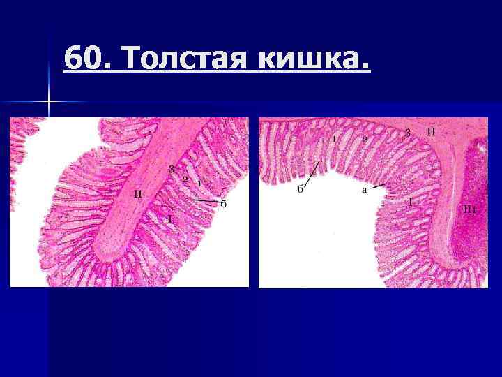 Толстая кишка гистология. Гистология толстой кишки. Препарат толстой кишки гистология. Толстый кишечник гистология.