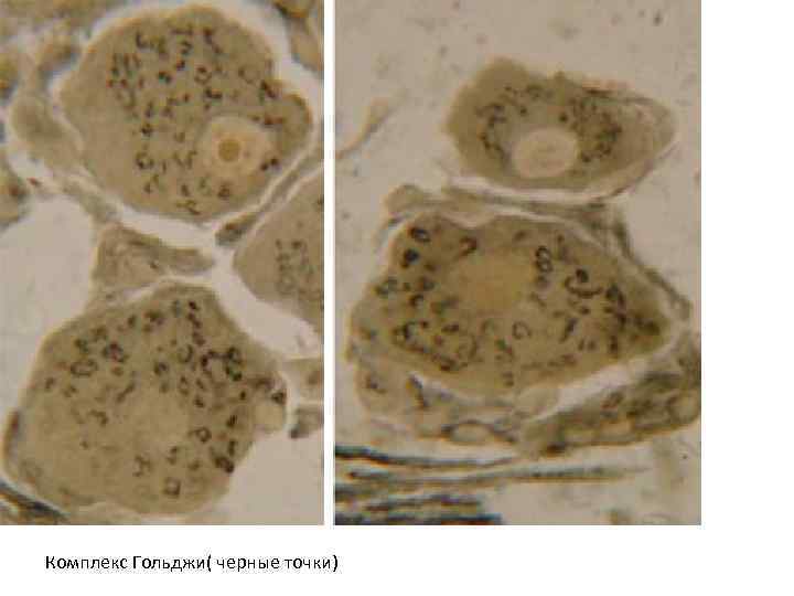 Комплекс Гольджи( черные точки) 