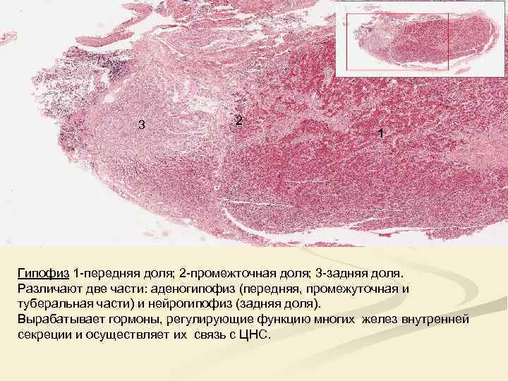 3 2 1 Гипофиз 1 -передняя доля; 2 -промежточная доля; 3 -задняя доля. Различают
