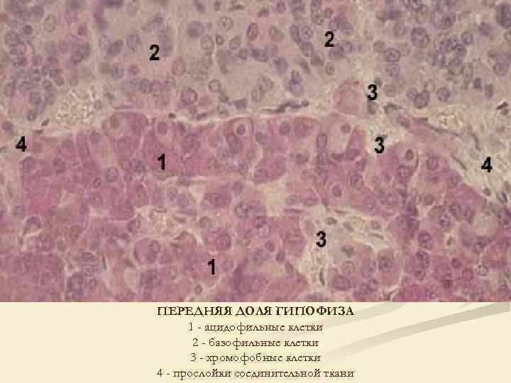 ПЕРЕДНЯЯ ДОЛЯ ГИПОФИЗА 1 - ацидофильные клетки 2 - базофильные клетки 3 - хромофобные