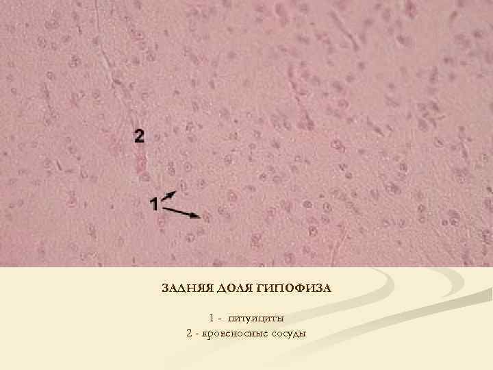 ЗАДНЯЯ ДОЛЯ ГИПОФИЗА 1 - питуициты 2 - кровеносные сосуды 