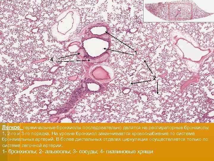1 4 2 Легкое. терминальные бронхиолы последовательно делятся на респираторные бронхиолы 1, 2 -го