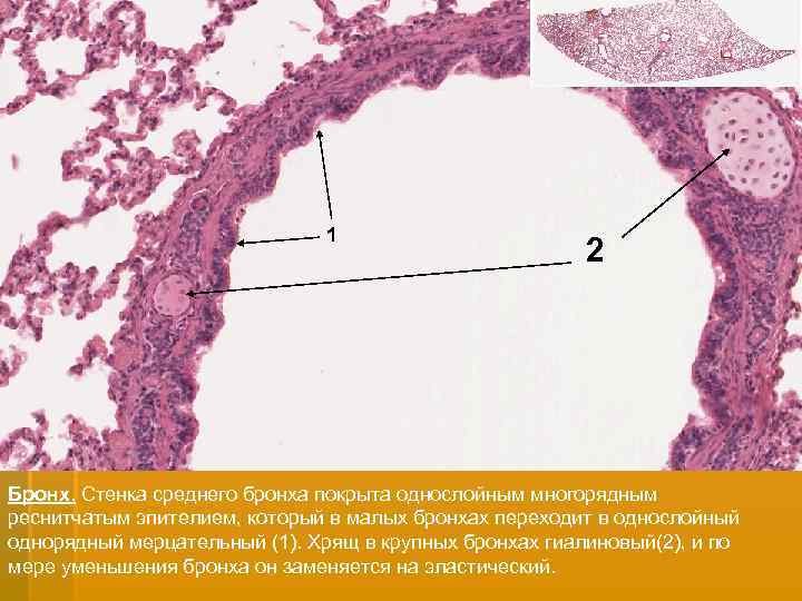 1 2 Бронх. Стенка среднего бронха покрыта однослойным многорядным реснитчатым эпителием, который в малых