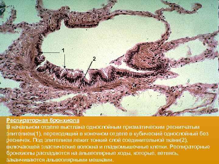 1 2 Респираторная бронхиола В начальном отделе выстлана однослойным призматическим реснитчатым эпителием(1), переходящий в