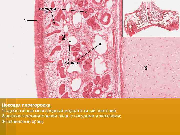 сосуды 1 2 железы Носовая перегородка. 1 -однослойный многорядный мерцательный эпителий; 2 -рыхлая соединительная