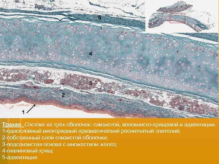 5 4 3 2 2 1 Трахея. Состоит из трех оболочек: слизистой, волокнисто-хрящевой и