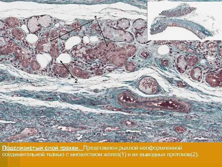 1 2 Подслизистый слой трахеи. Представлен рыхлой неоформленной соединительной тканью с множеством желез(1) и