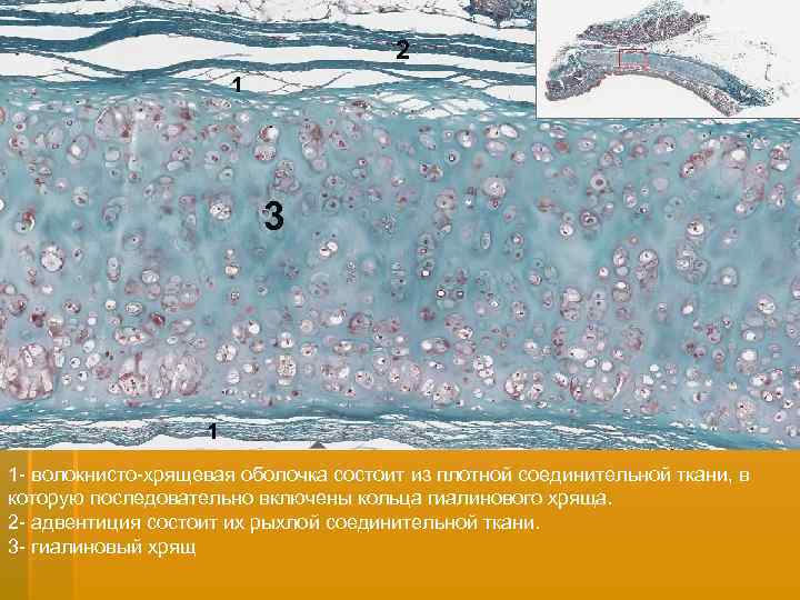 2 1 3 1 1 - волокнисто-хрящевая оболочка состоит из плотной соединительной ткани, в
