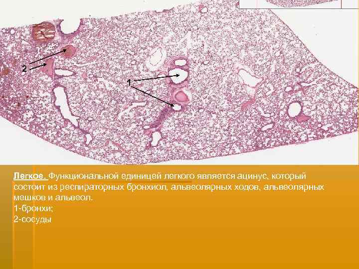 2 1 Легкое. Функциональной единицей легкого является ацинус, который состоит из респираторных бронхиол, альвеолярных