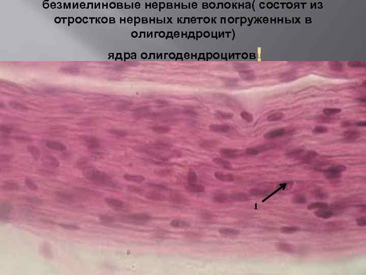 Безмиелиновые нервные волокна гистология рисунок