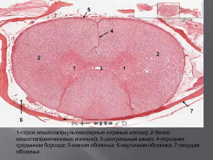 5 4 2 2 1 3 1 7 6 1 -серое вещество(мультиполярные нервные клетки);