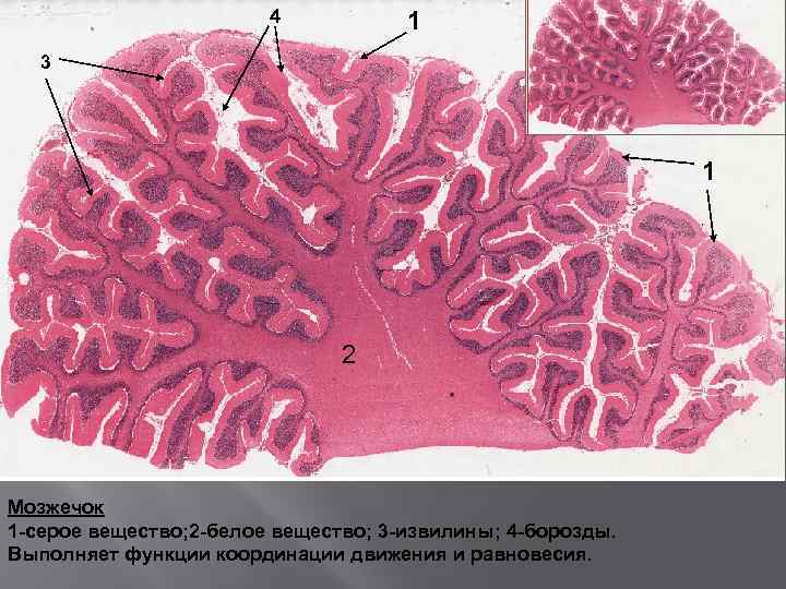 4 1 3 1 2 Мозжечок 1 -серое вещество; 2 -белое вещество; 3 -извилины;