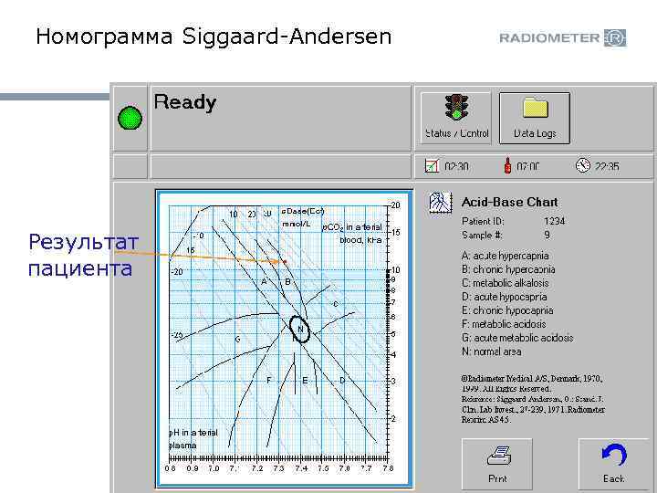 Номограмма Siggaard-Andersen Результат пациента 