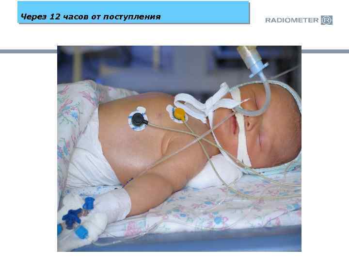 Через 12 часов от поступления 