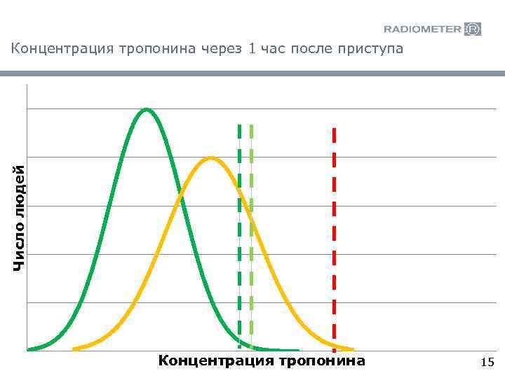 Число людей Концентрация тропонина через 1 час после приступа Концентрация тропонина 15 