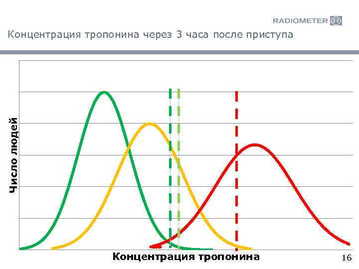 Число людей Концентрация тропонина через 3 часа после приступа Концентрация тропонина 16 