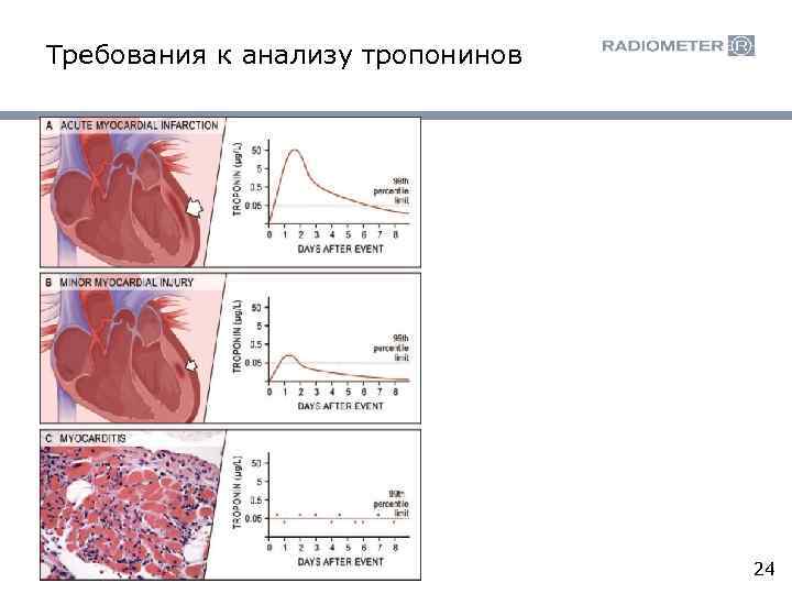 Требования к анализу тропонинов 24 