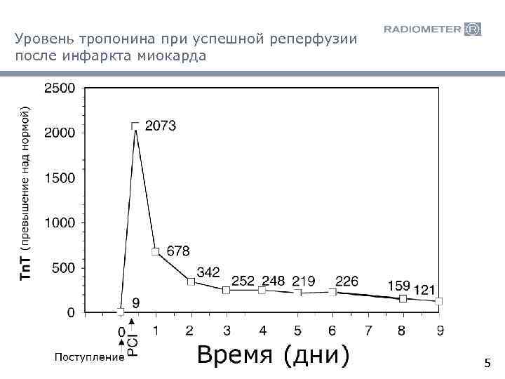 Уровень тропонина при успешной реперфузии после инфаркта миокарда 5 