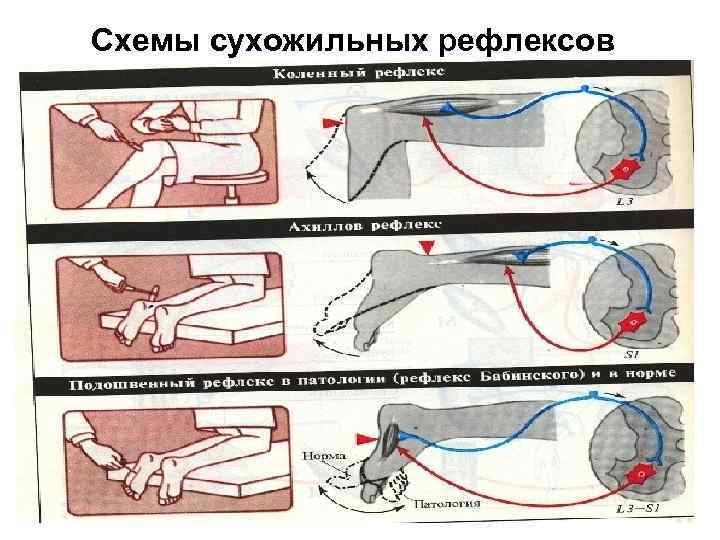 Схемы сухожильных рефлексов 