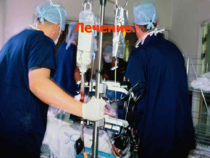 Лечение. 